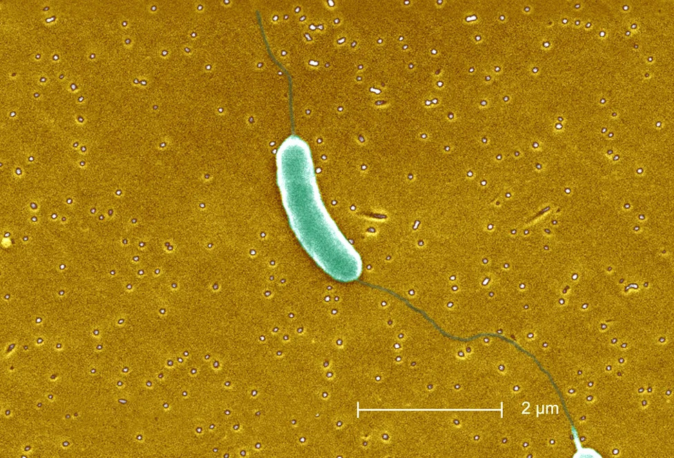 Five Killed In Flesh-Eating Bacteria Outbreak In Louisiana