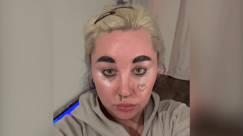 Amanda Bynes shared she is 'really glad' to be 'on the injection.'@AMANDAPANDAPANDAPANDA1/INSTAGRAM