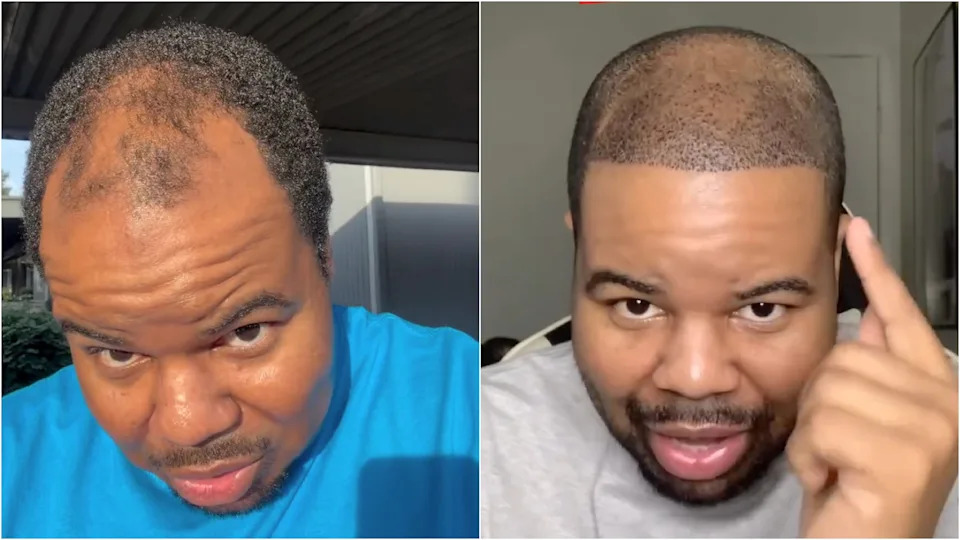 The reality star showed off his early one-week results to his followers. / Instagram/ Tyray Mollett
