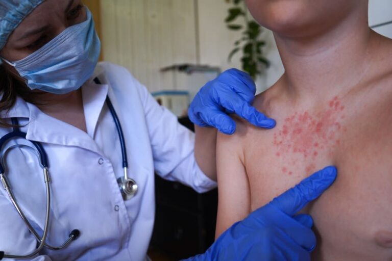 Possible measles infections reported in Asheville related to Holiday Inn Express visit