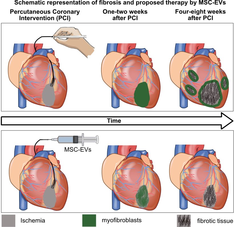 The figure shows how the heart changes after a major heart attack and how the...
