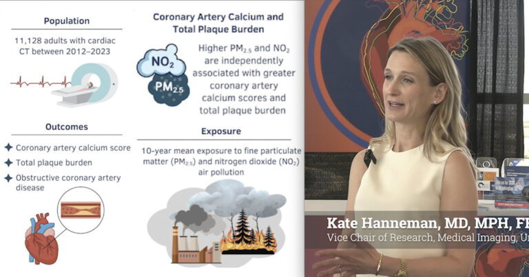 Cardiac CT links air pollution to increased risk of coronary disease