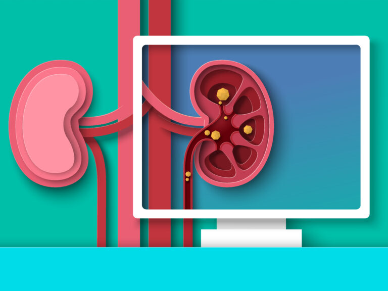 Study points to new therapeutic target for chronic kidney disease Study points to new therapeutic target for chronic kidney disease