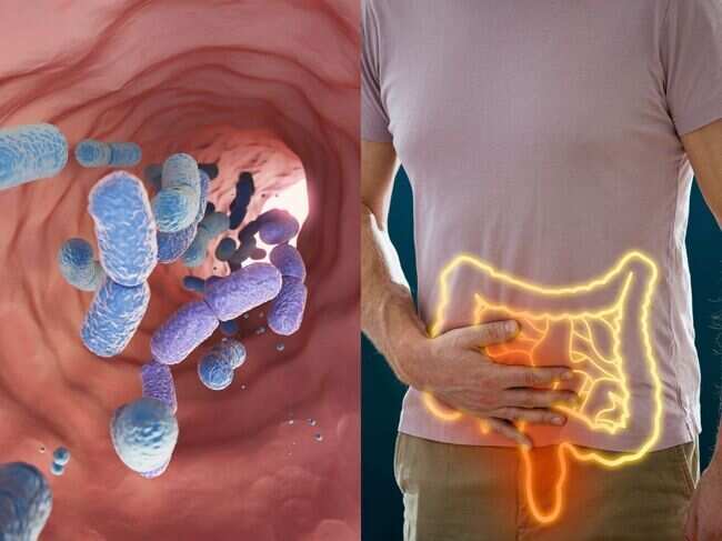 Low fibre can push gut bacteria towards the gut lining