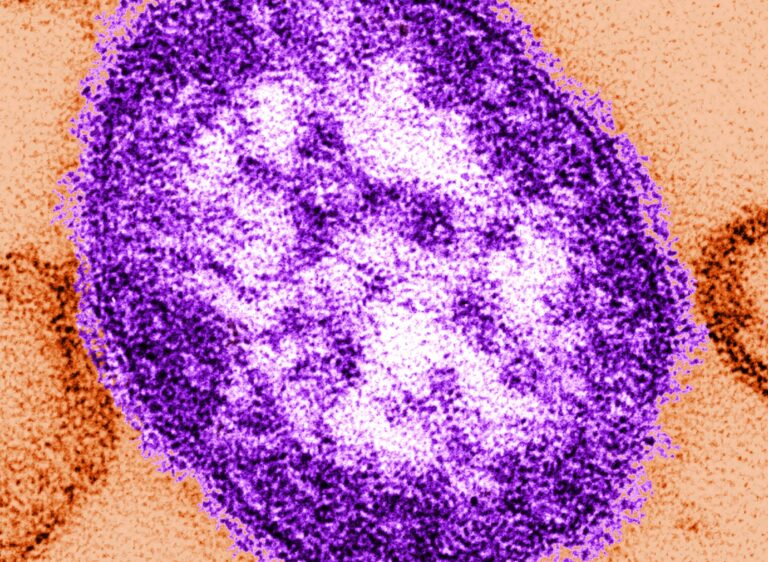 2 unvaccinated Pennsylvanians die after contracting measles as cases grow