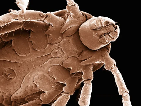 Getty Images A dog tick as seen under a scanning electron microscope (Credit: Getty Images)