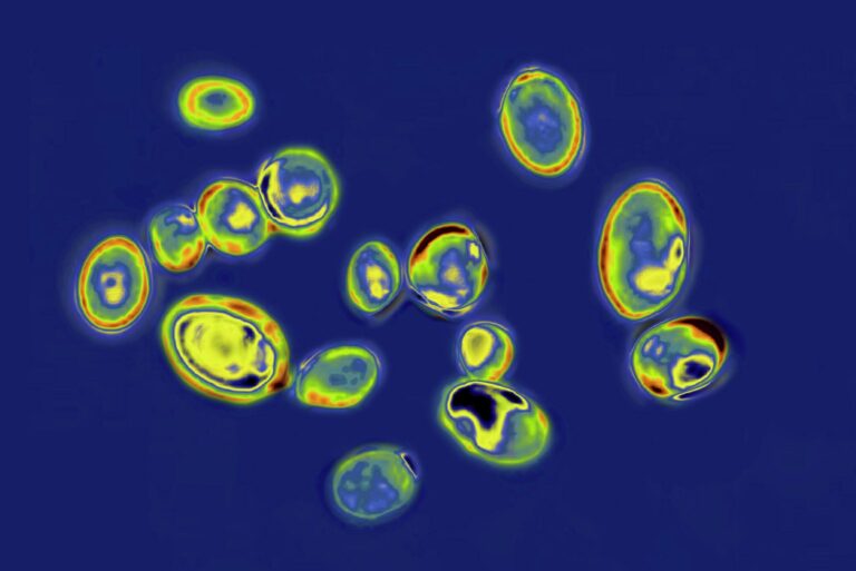 Texas leads nation in Candida auris cases as the drug Texas leads nation in Candida auris cases as the drug