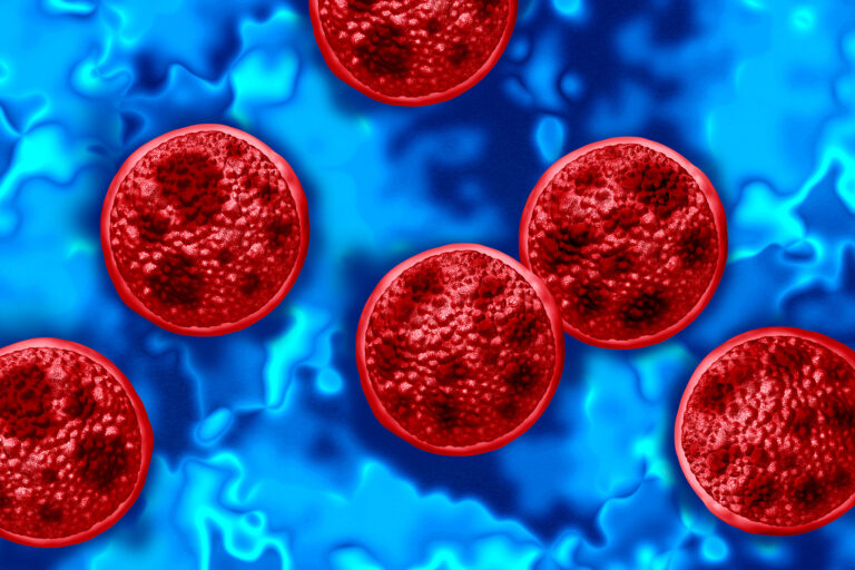 Diarrhea-causing disease hits double average cases in California Diarrhea-causing disease hits double average cases in California