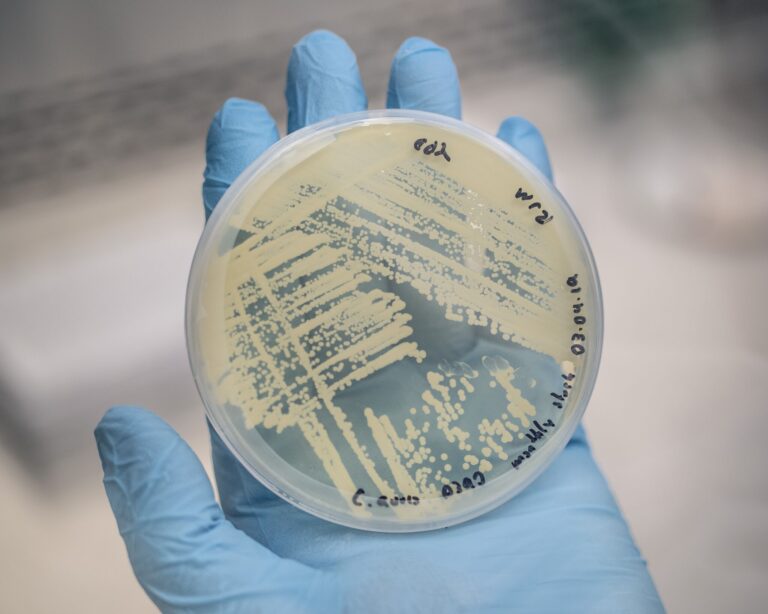 Texas leads the nation in potentially deadly strain of fungal infections