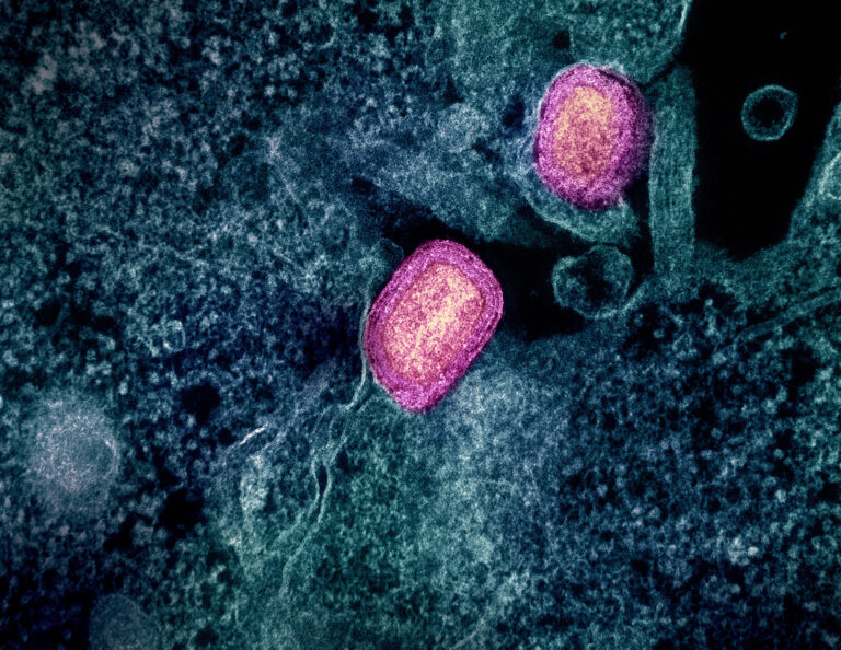 SF: Health Officials Renew Mpox Vaccine Push SF: Health Officials Renew Mpox Vaccine Push