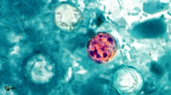 Texas reports dozens more cyclospora cases in the past week Texas reports dozens more cyclospora cases in the past week