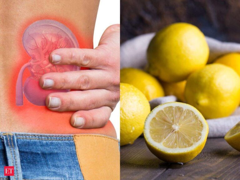 7 everyday foods that can help prevent kidney stones forming 7 everyday foods that can help prevent kidney stones forming