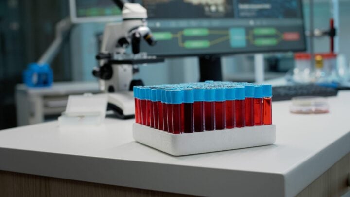 Schizophrenia Diagnosis: How PBMC Biomarkers Can Help in Early Detection Schizophrenia Diagnosis: How PBMC Biomarkers Can Help in Early Detection