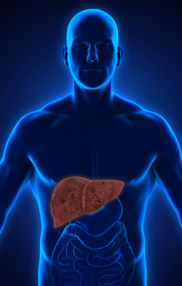 Study Identifies Potential Therapeutic Target Protein that Drives Metabolic Liver Disease Independent of Diet