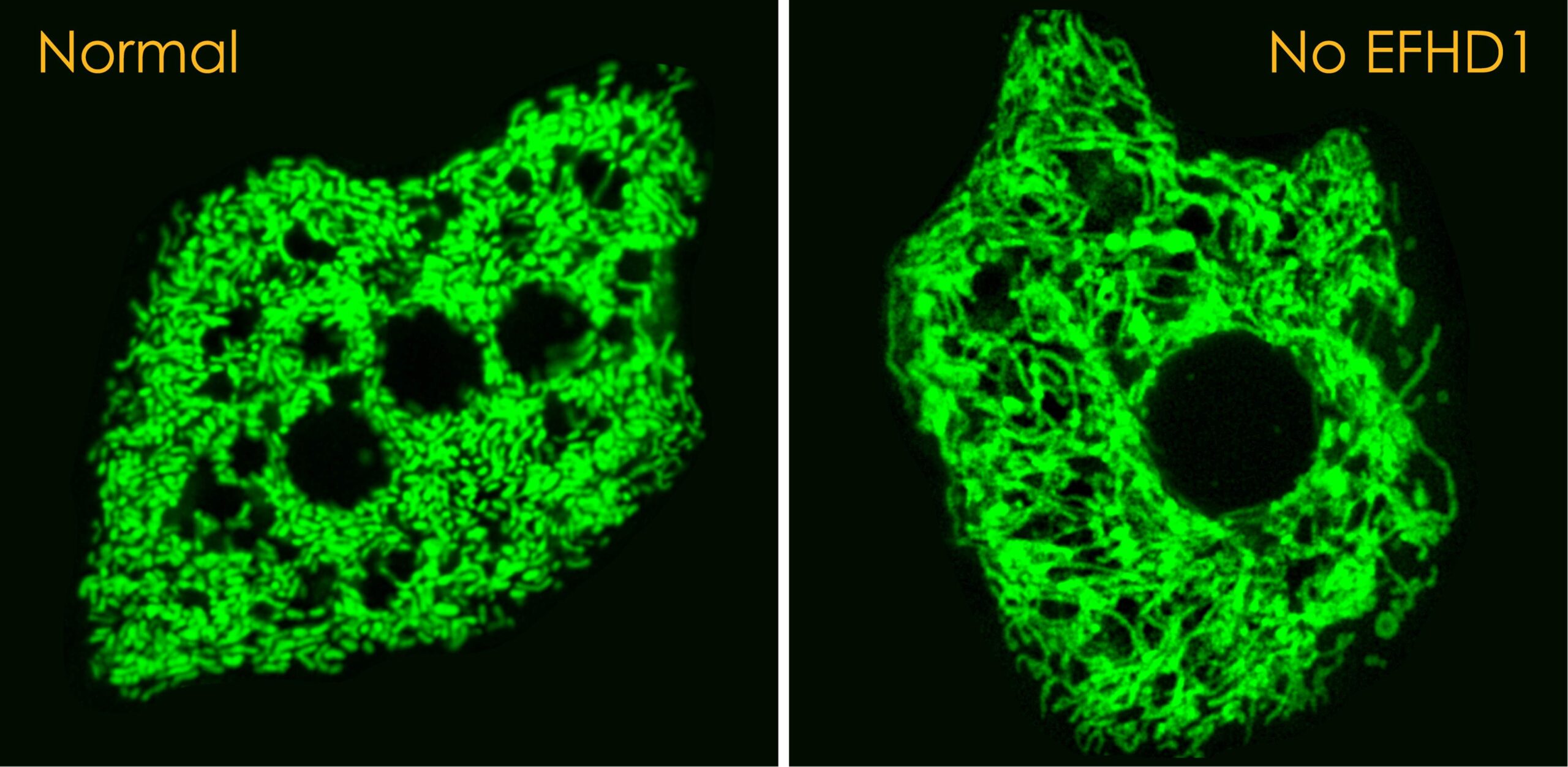 Two microscope images of cells filled with fluorescent green mitochondria.